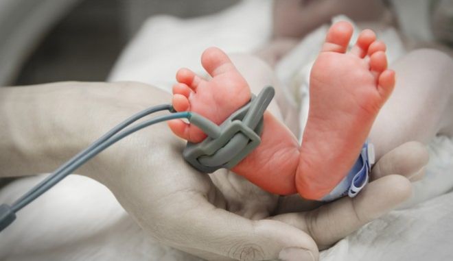 Βραζιλία: Μωρό γεννήθηκε με ουρά 12 εκατοστών!