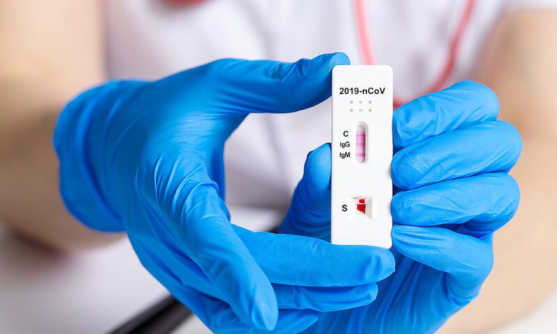 ΕΟΔΥ: Τα σημεία και οι ώρες για δωρεάν rapid tests σήμερα (23/1)