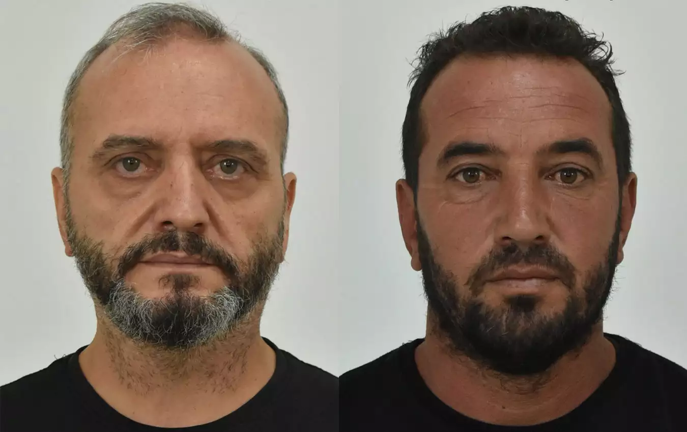 Κολωνός: Ο 53χρονος «έδωσε» την μητέρα της 12χρονης – Αρνείται τα πάντα η 37χρονη μητέρα