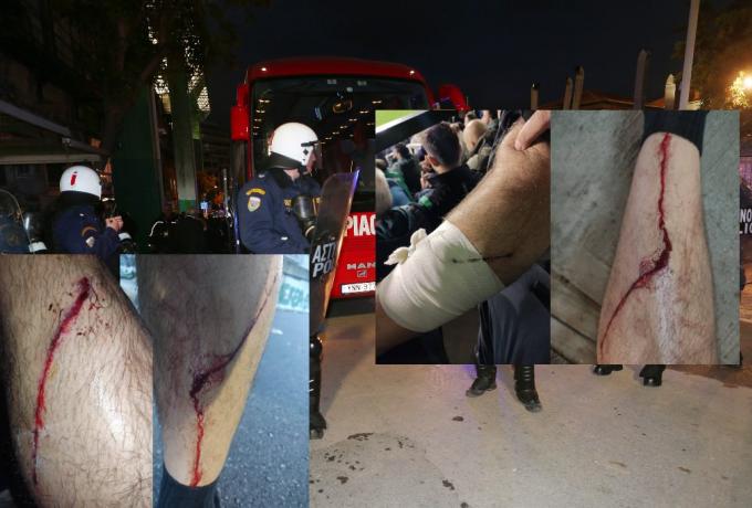 Καταγγελία για αστυνομική βία και στη Λεωφόρο!