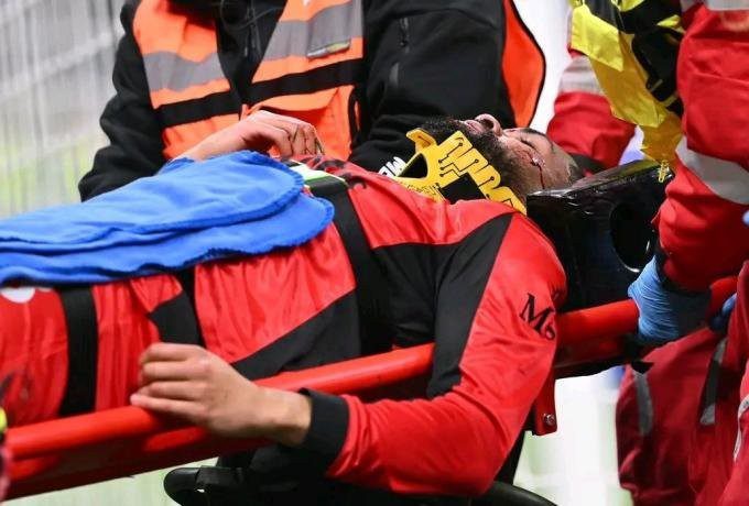 Μίλαν: Χειρουργήθηκε ο Λόφτους-Τσικ μετά τον τραυματισμό με την Πάρμα